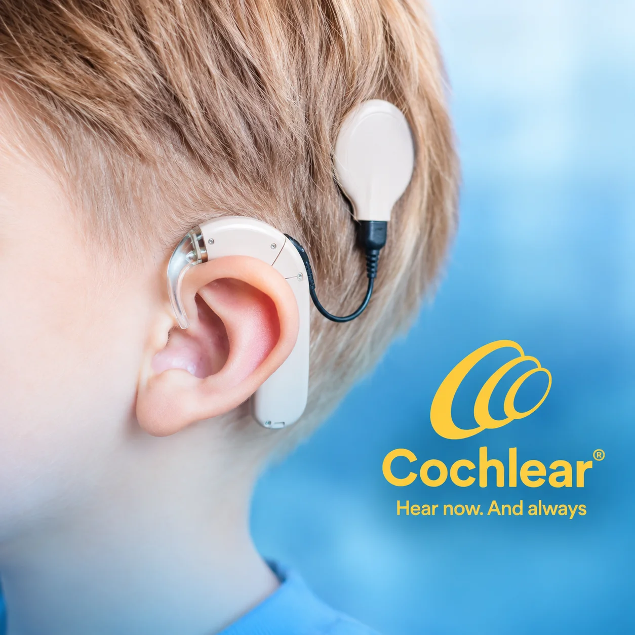 GMT Pvt Ltd Products Cochlear hearing implant